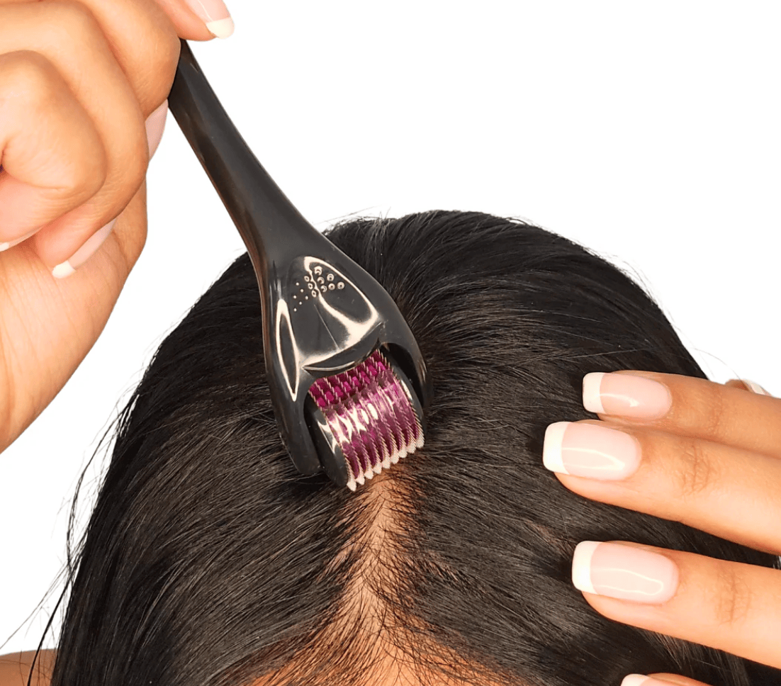 I'm Hair For You Always - Scalp Derma Roller