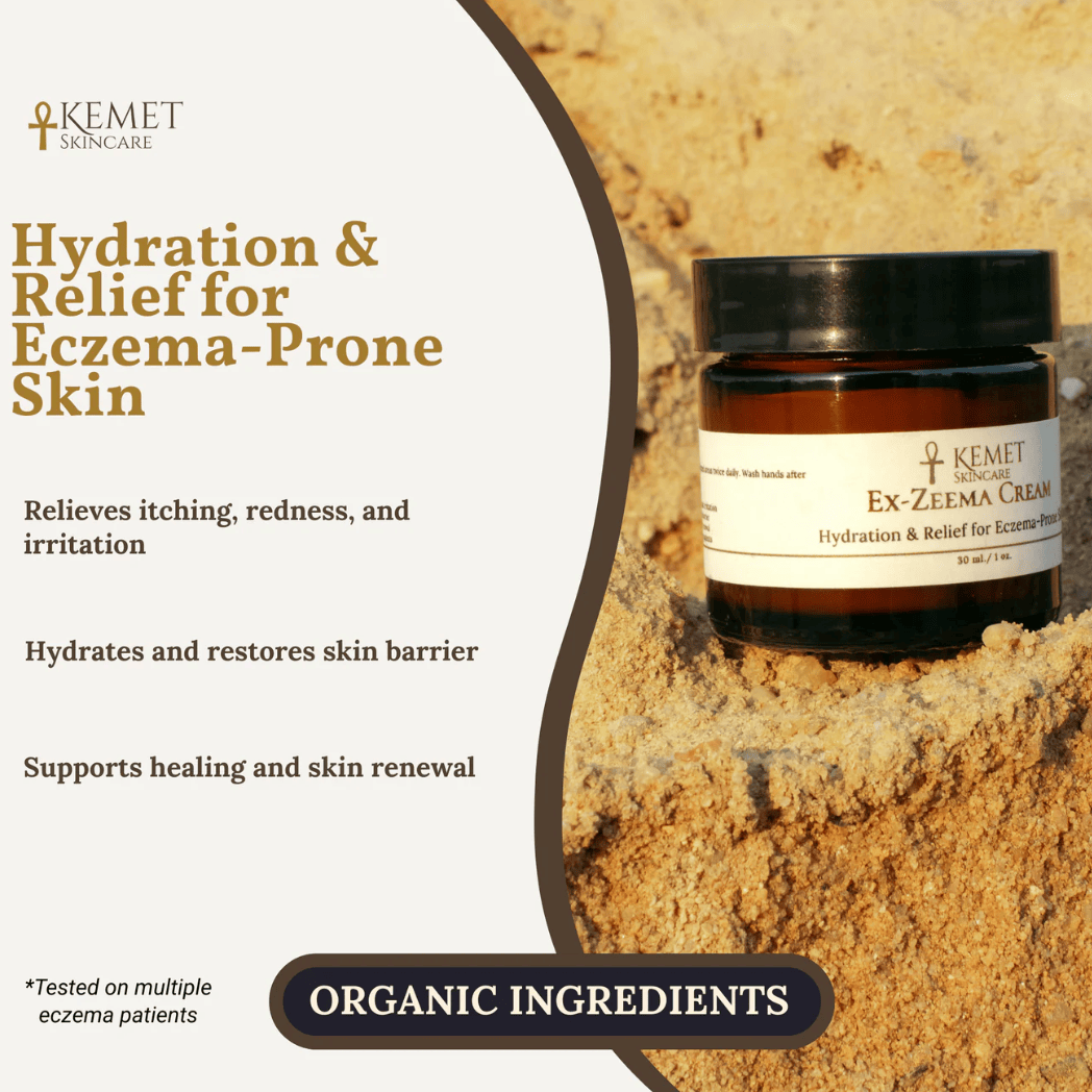Kemet Ex-Zeema Cream for eczema-prone skin - Screenshot 2025-08-08