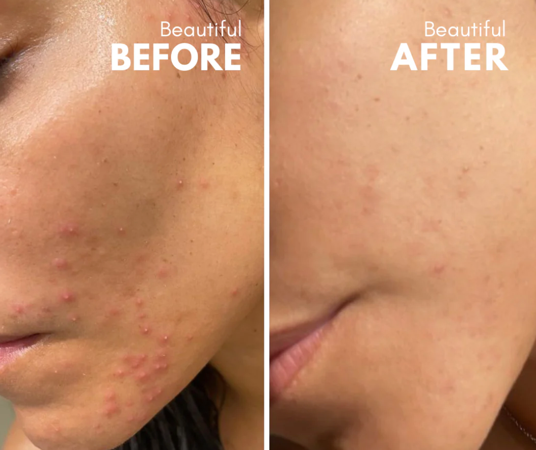 Stoic Beauty - APOKATHARIO Natural Exfoliating Serum