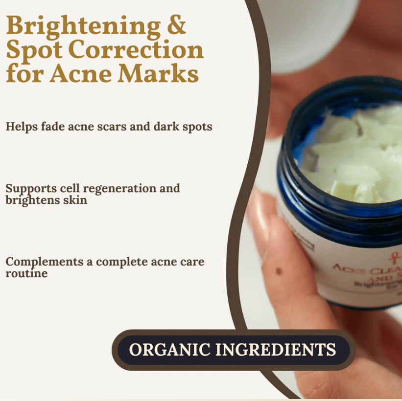 Acne mark cream with organic ingredients, Screenshot from Aug 13, 2025.