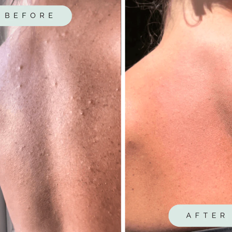 Wildpier Deep Exfoliating Towel